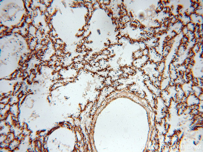 PIH1D1 Antibody in Immunohistochemistry (Paraffin) (IHC (P))