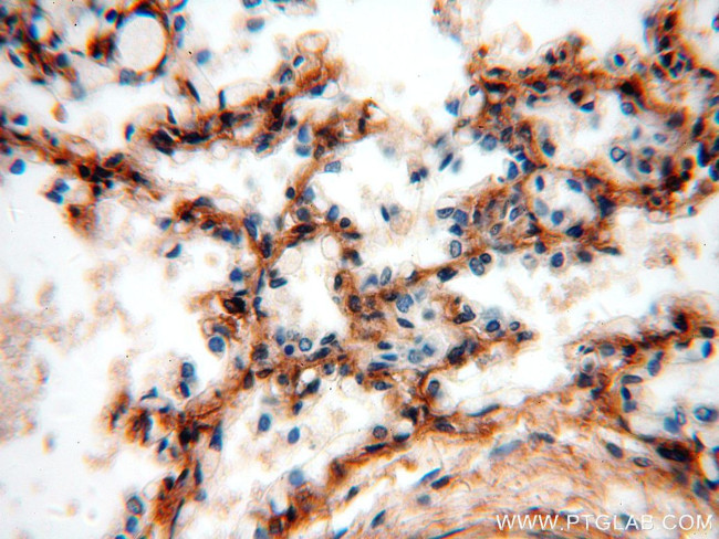 PIH1D1 Antibody in Immunohistochemistry (Paraffin) (IHC (P))