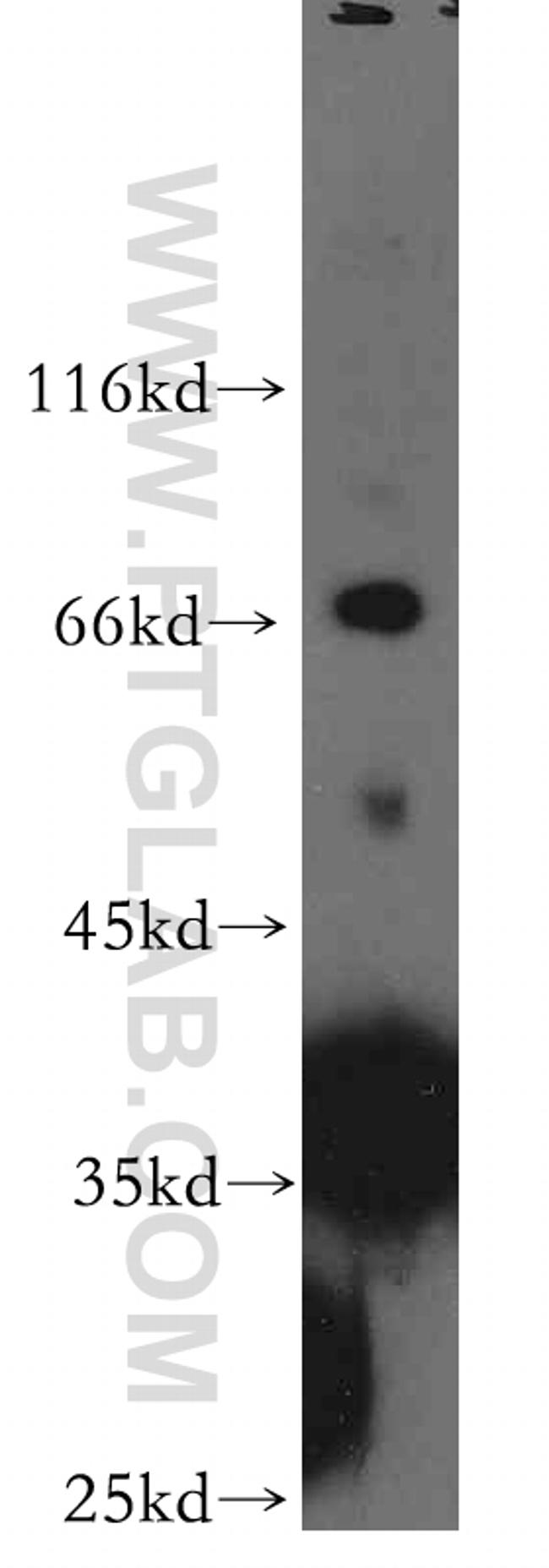 PIH1D1 Antibody in Western Blot (WB)