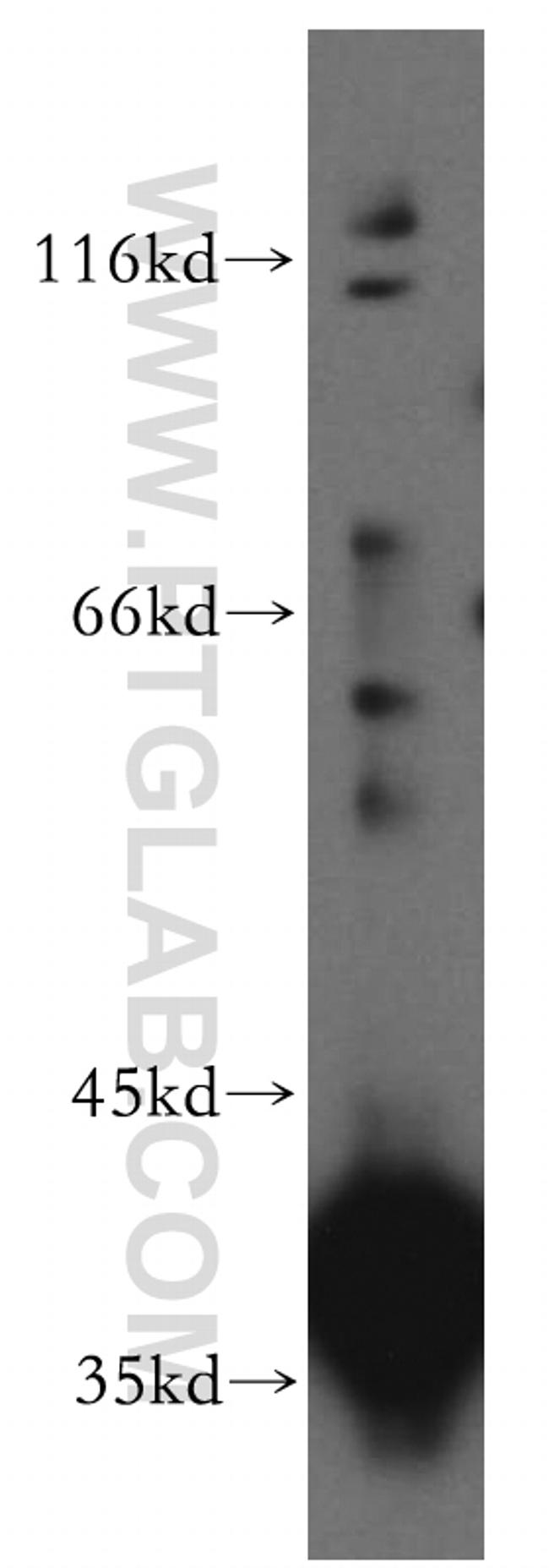 PIH1D1 Antibody in Western Blot (WB)