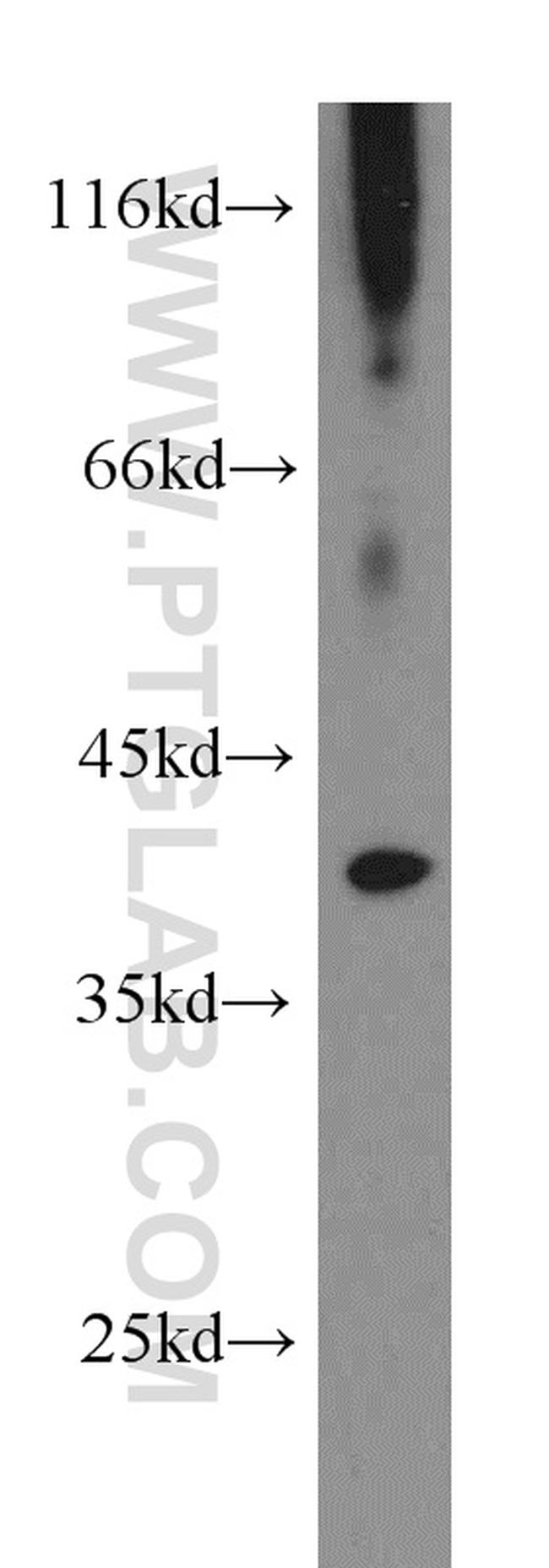 PIH1D1 Antibody in Western Blot (WB)