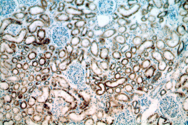 ZIP7 Antibody in Immunohistochemistry (Paraffin) (IHC (P))