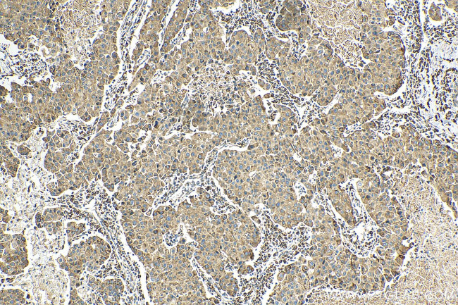 ZIP7 Antibody in Immunohistochemistry (Paraffin) (IHC (P))