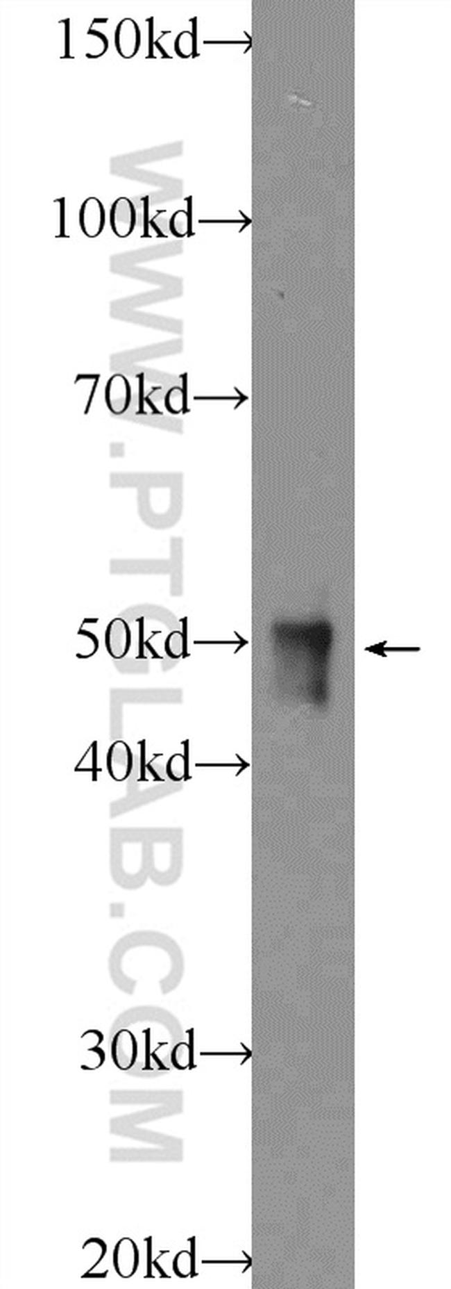 ZIP7 Antibody in Western Blot (WB)