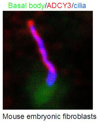 ADCY3 Antibody in Immunohistochemistry (IHC)