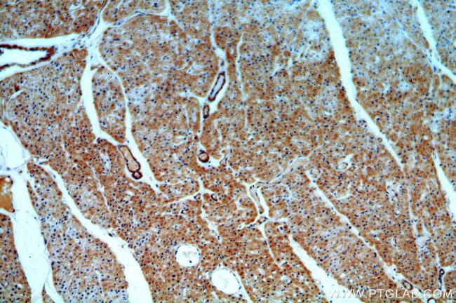 ADCY3 Antibody in Immunohistochemistry (Paraffin) (IHC (P))