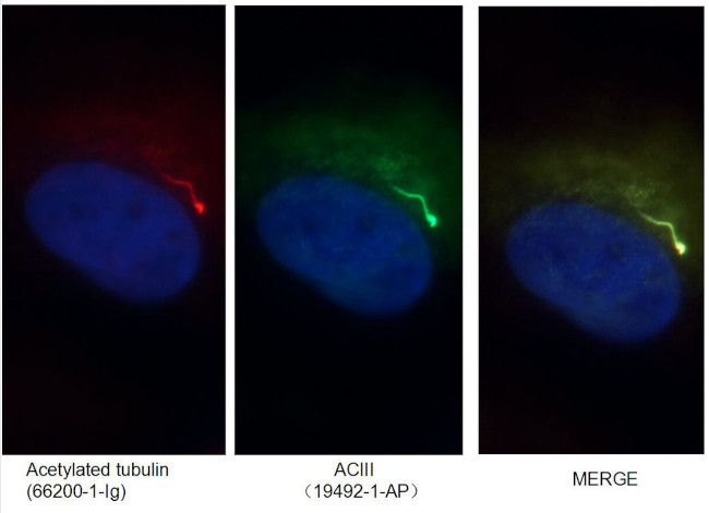 ADCY3 Antibody in Immunocytochemistry (ICC/IF)