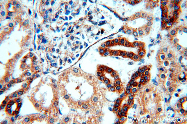 ADCY3 Antibody in Immunohistochemistry (Paraffin) (IHC (P))