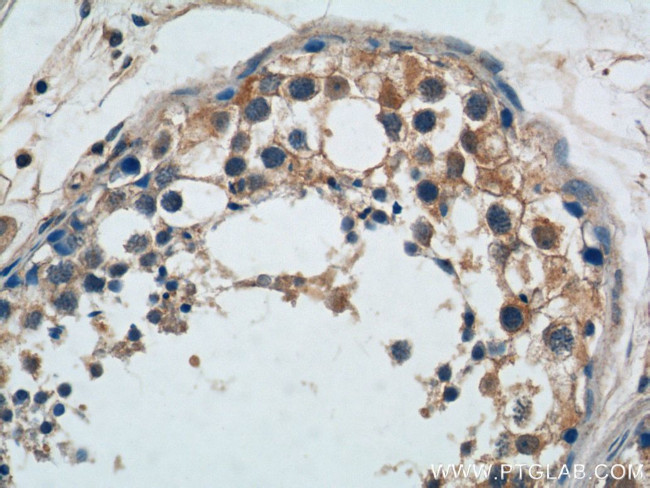 TICAM2 Antibody in Immunohistochemistry (Paraffin) (IHC (P))