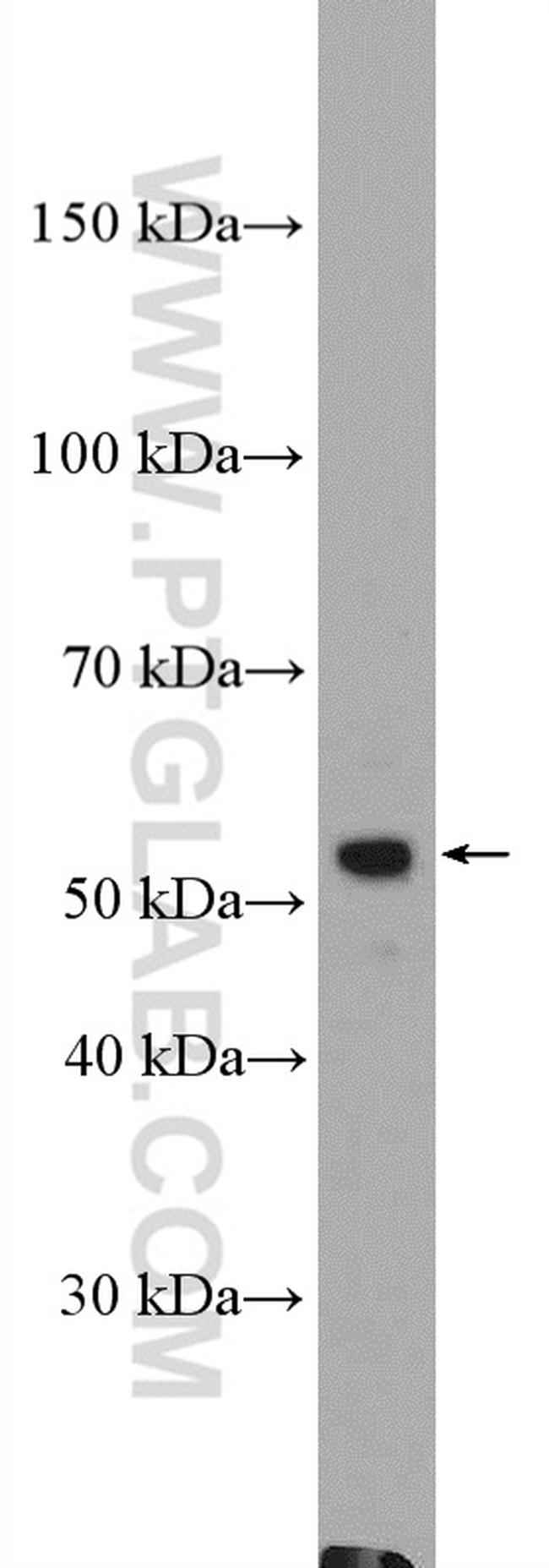 ZIP kinase Antibody in Western Blot (WB)