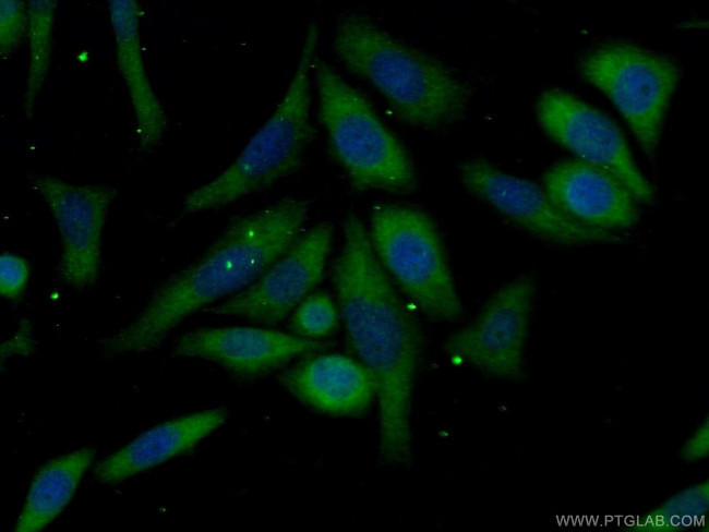 ZIP kinase Antibody in Immunocytochemistry (ICC/IF)