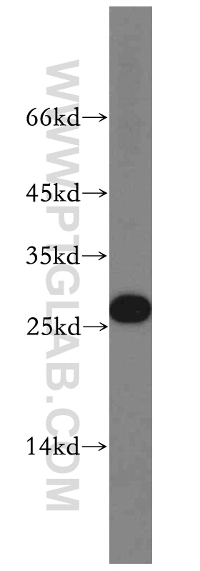 MXD1 Antibody in Western Blot (WB)