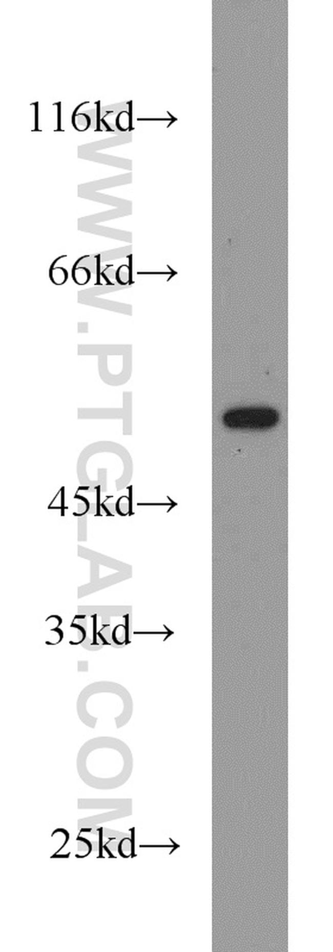 RUNX1 (N-terminal) Antibody in Western Blot (WB)