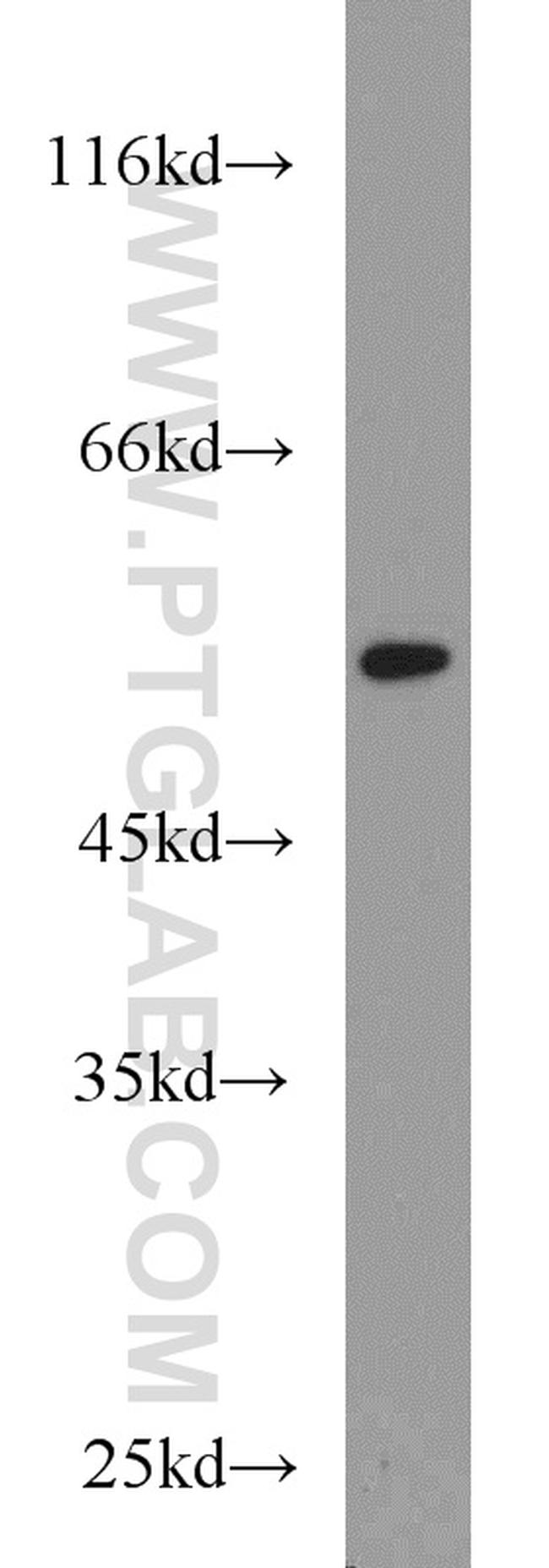 RUNX1 (N-terminal) Antibody in Western Blot (WB)