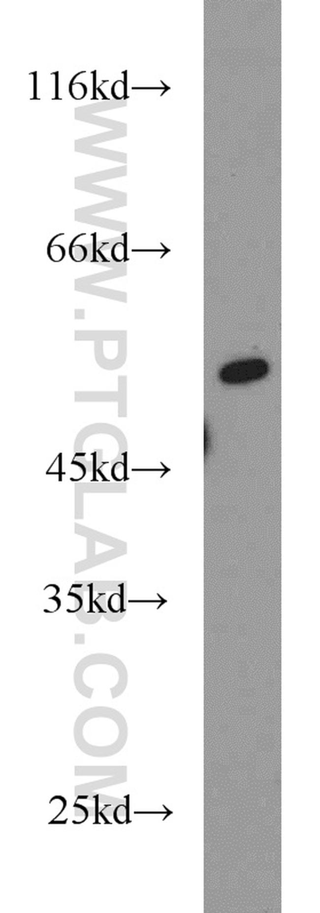 RUNX1 (N-terminal) Antibody in Western Blot (WB)