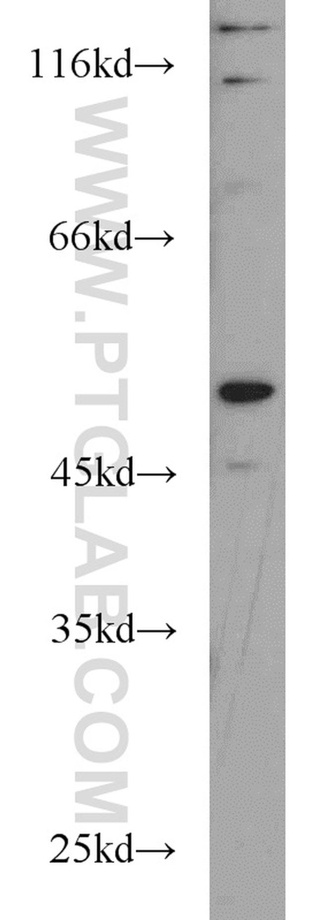 RUNX1 (N-terminal) Antibody in Western Blot (WB)