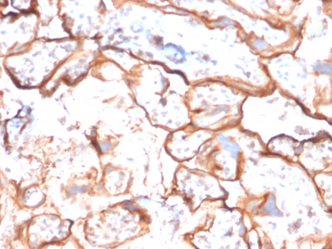 EGFR (Epidermal Growth Factor Receptor) Antibody in Immunohistochemistry (Paraffin) (IHC (P))