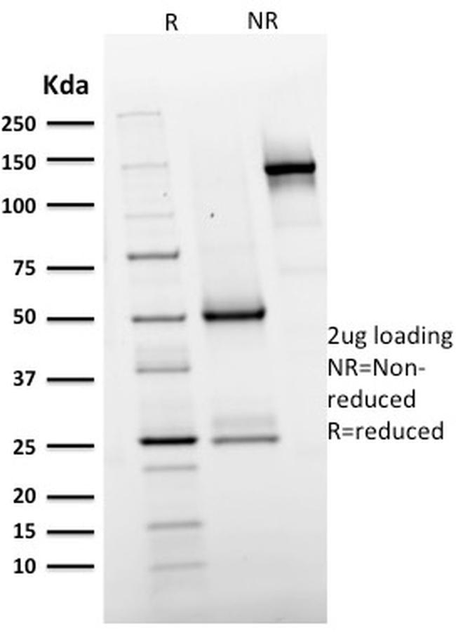 EGFR (Epidermal Growth Factor Receptor) Antibody in SDS-PAGE (SDS-PAGE)