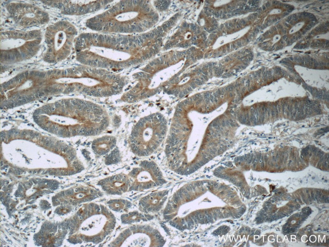 MUTYH Antibody in Immunohistochemistry (Paraffin) (IHC (P))