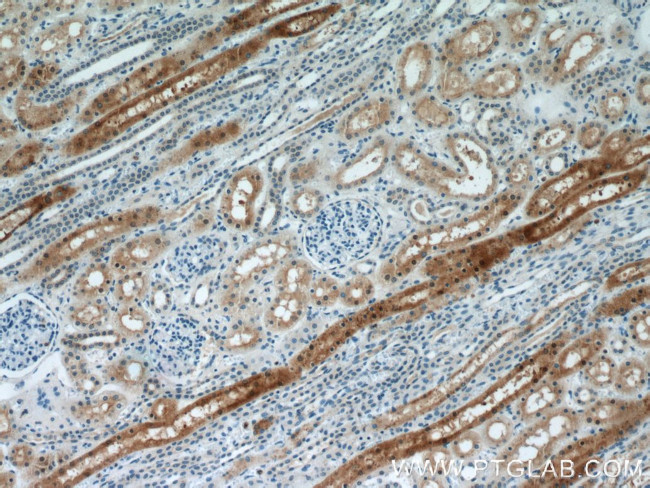 MUTYH Antibody in Immunohistochemistry (Paraffin) (IHC (P))