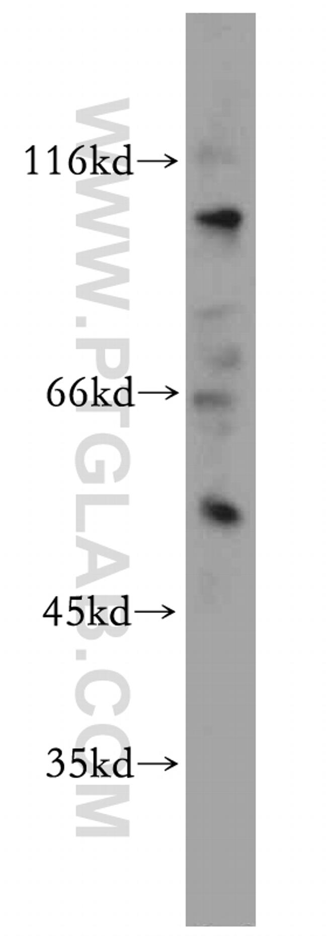 MUTYH Antibody in Western Blot (WB)