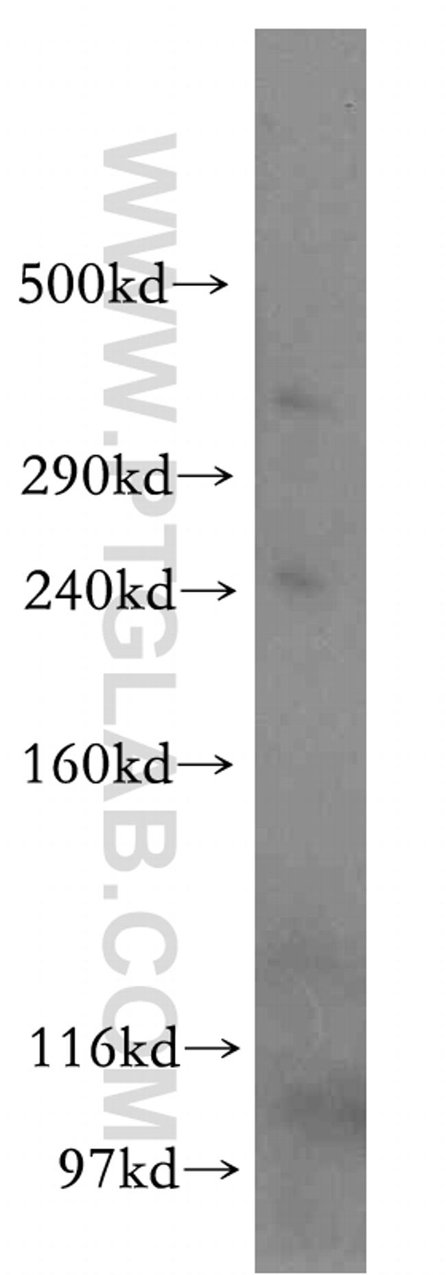 HSPG2 Antibody in Western Blot (WB)