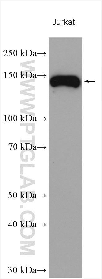 Integrin alpha-4 Antibody in Western Blot (WB)