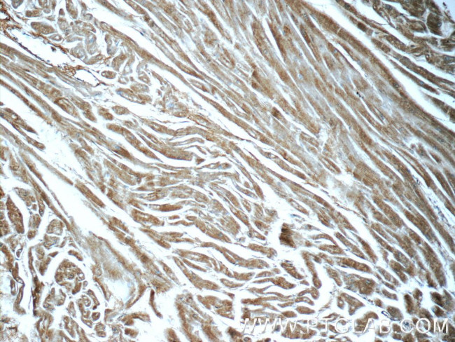 BAI2 Antibody in Immunohistochemistry (Paraffin) (IHC (P))