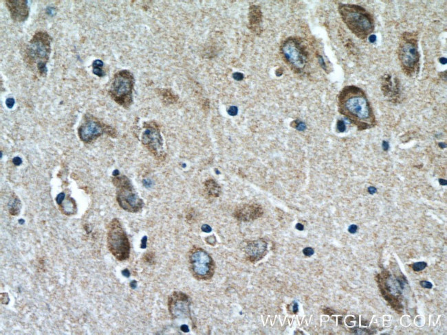 LIMK1 Antibody in Immunohistochemistry (Paraffin) (IHC (P))