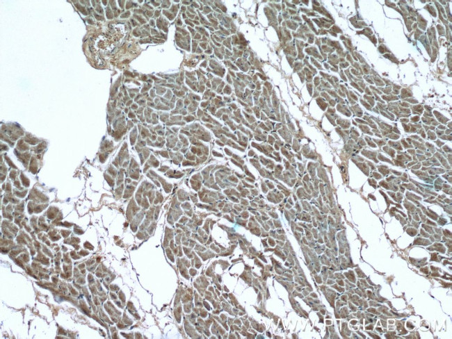 LIMK1 Antibody in Immunohistochemistry (Paraffin) (IHC (P))