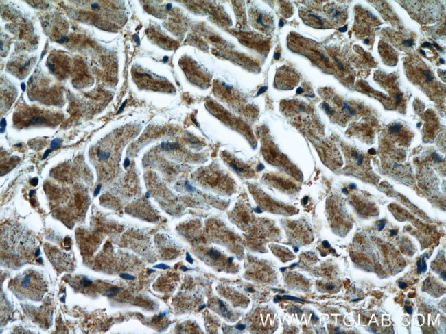 LIMK1 Antibody in Immunohistochemistry (Paraffin) (IHC (P))