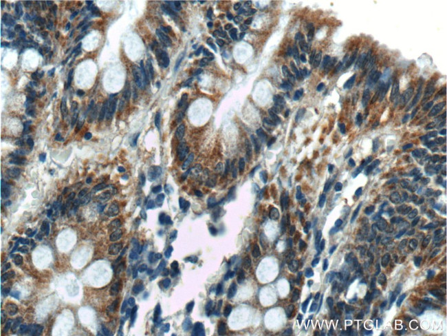 Thrombospondin 3 Antibody in Immunohistochemistry (Paraffin) (IHC (P))