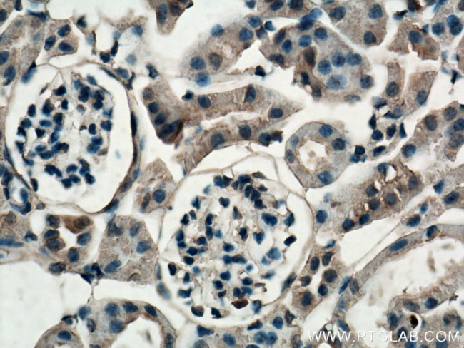 Thrombospondin 3 Antibody in Immunohistochemistry (Paraffin) (IHC (P))