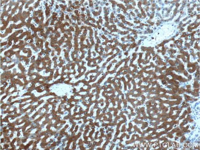 Thrombospondin 3 Antibody in Immunohistochemistry (Paraffin) (IHC (P))