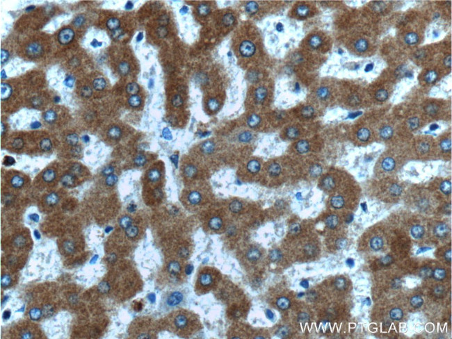 Thrombospondin 3 Antibody in Immunohistochemistry (Paraffin) (IHC (P))