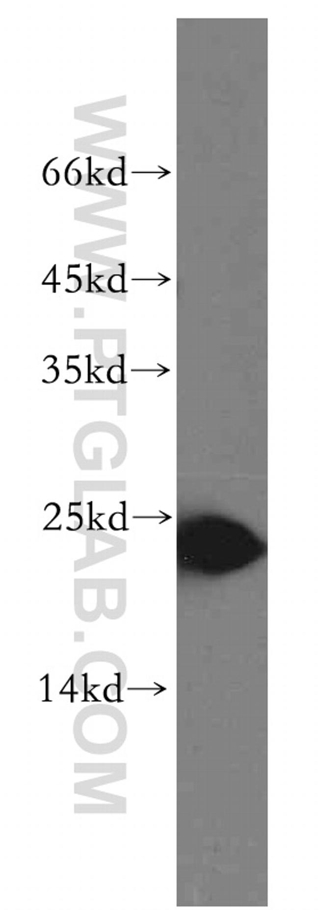 Urocortin Antibody in Western Blot (WB)