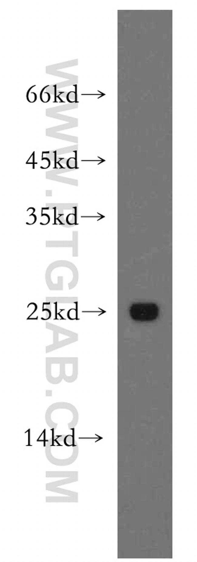 Urocortin Antibody in Western Blot (WB)