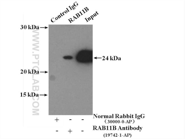 RAB11B Antibody in Immunoprecipitation (IP)
