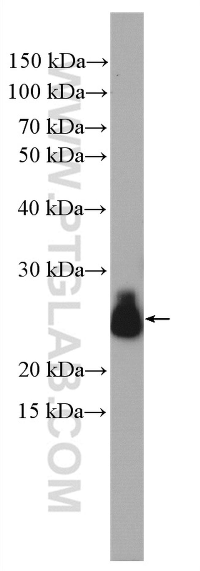 RAB11B Antibody in Western Blot (WB)