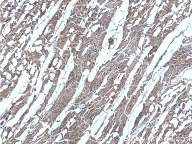 ADRA1B Antibody in Immunohistochemistry (Paraffin) (IHC (P))