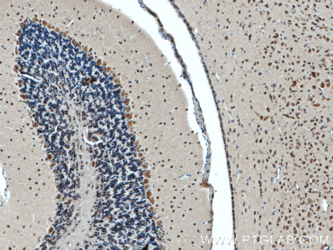 ATP7B Antibody in Immunohistochemistry (Paraffin) (IHC (P))