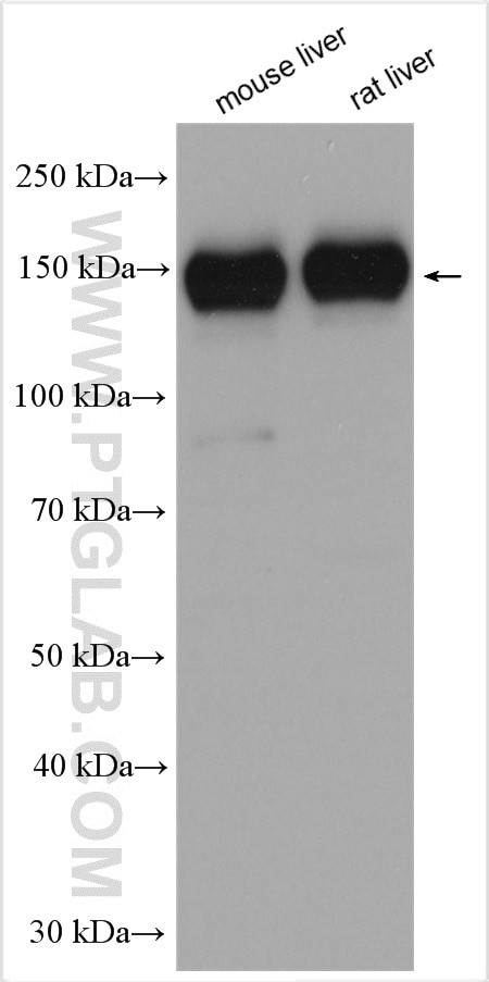 ATP7B Antibody in Western Blot (WB)