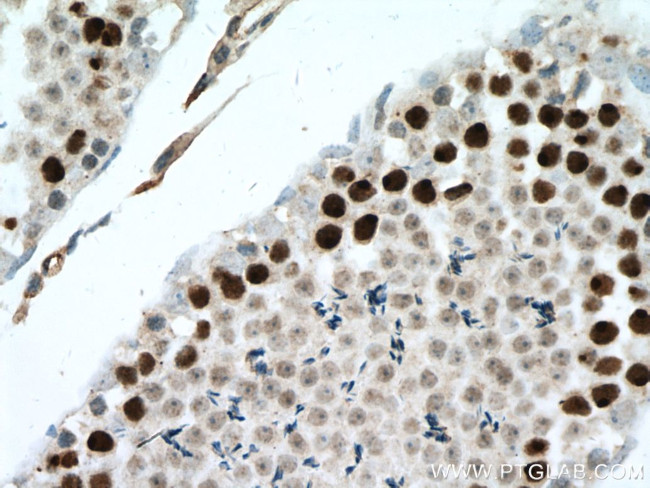 ATR Antibody in Immunohistochemistry (Paraffin) (IHC (P))