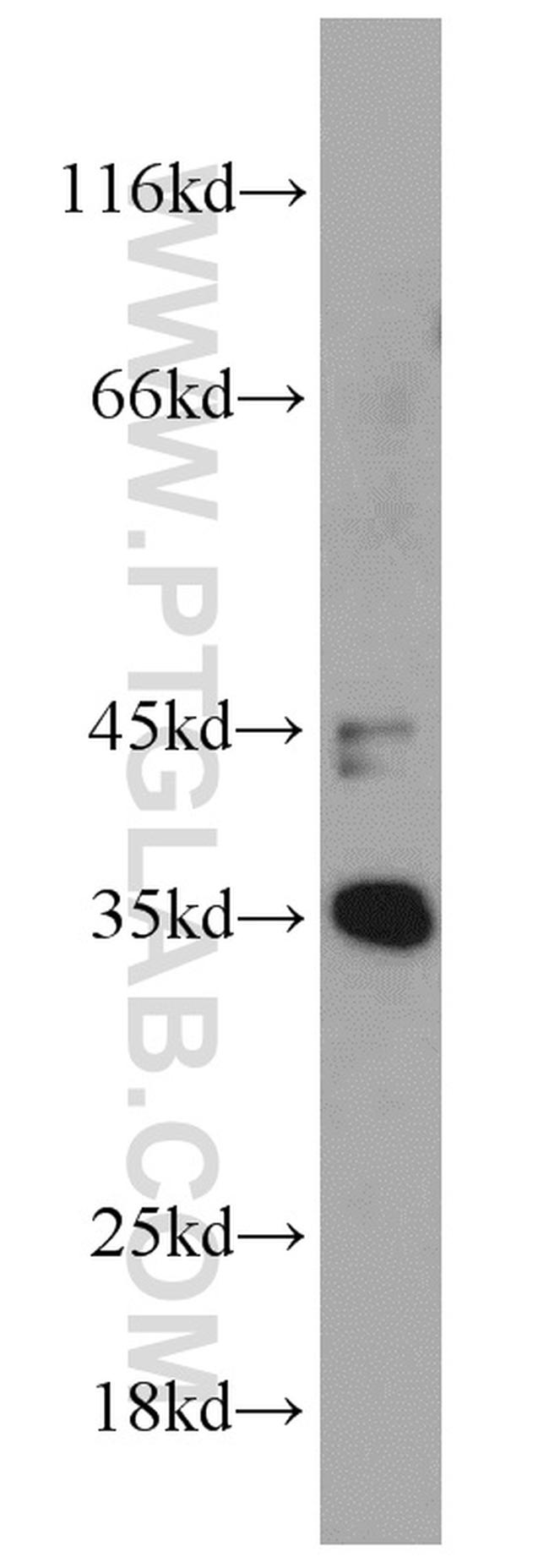 NUP53 Antibody in Western Blot (WB)
