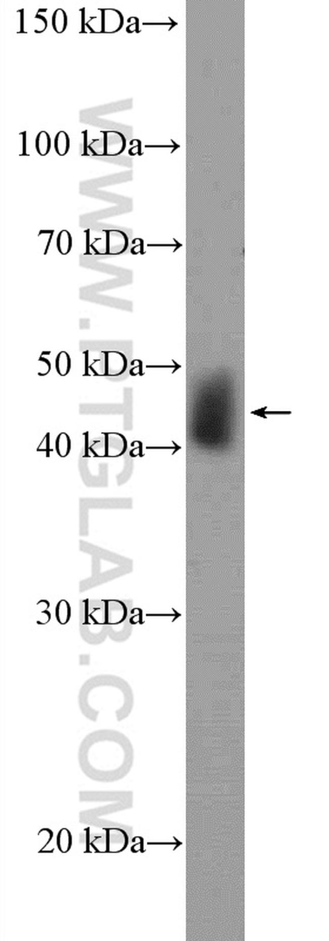 UBAC1 Antibody in Western Blot (WB)