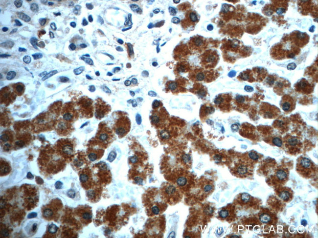 C14orf166 Antibody in Immunohistochemistry (Paraffin) (IHC (P))