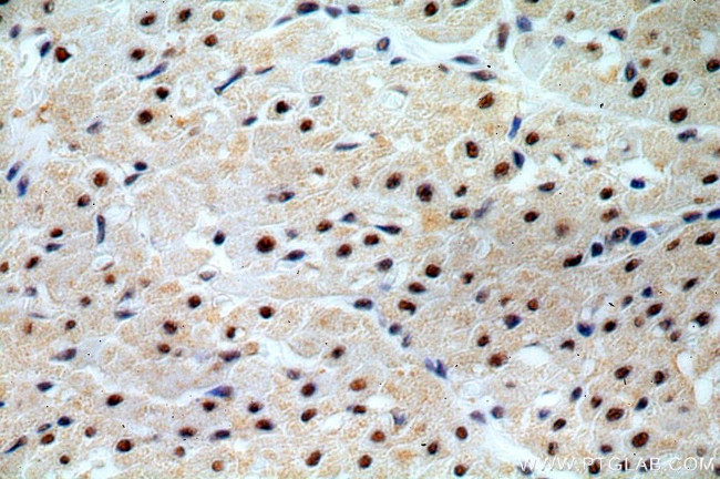 C14orf166 Antibody in Immunohistochemistry (Paraffin) (IHC (P))