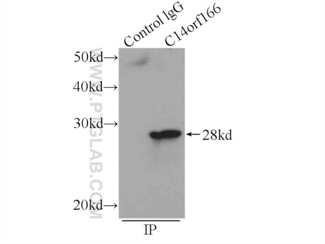 C14orf166 Antibody in Immunoprecipitation (IP)