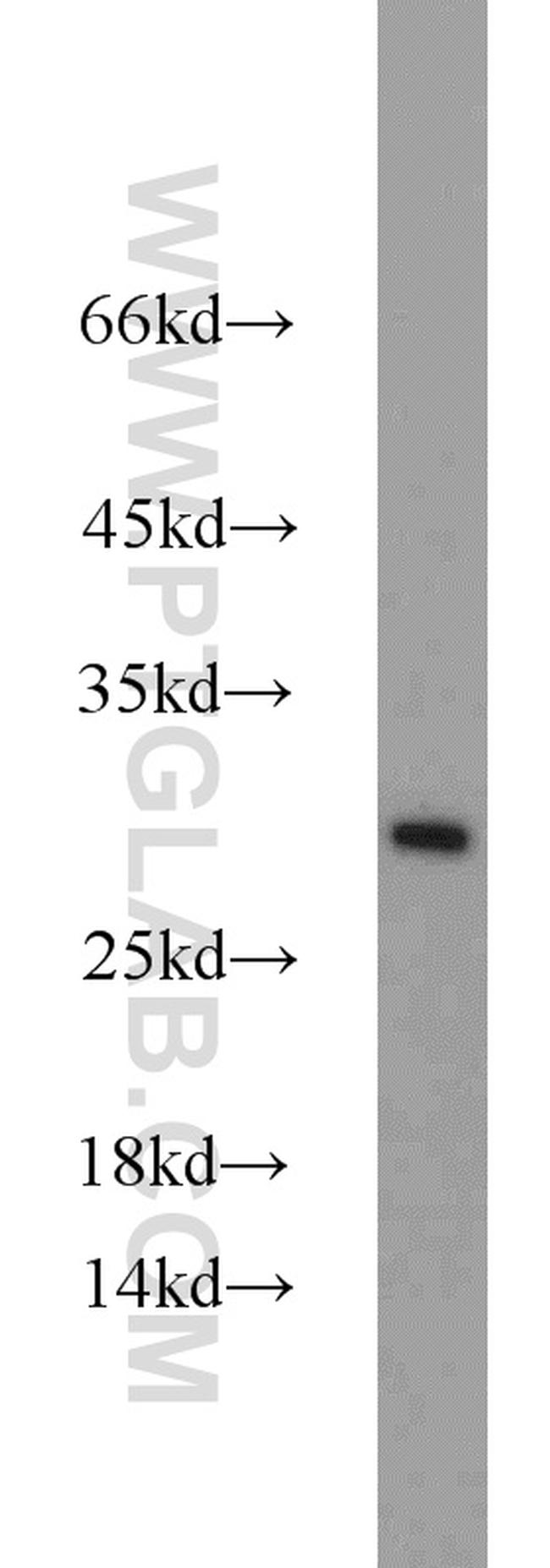 C14orf166 Antibody in Western Blot (WB)