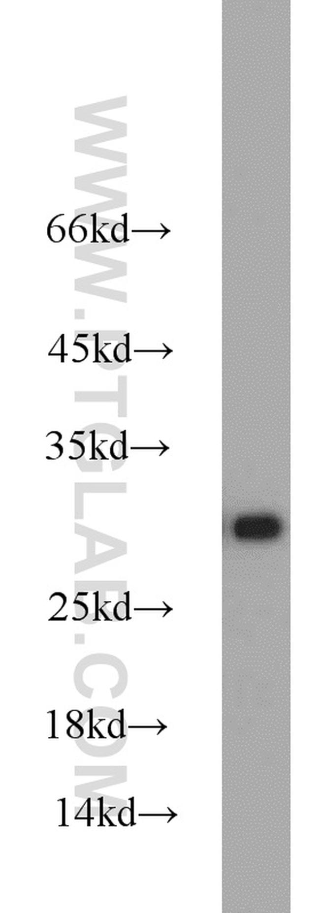 C14orf166 Antibody in Western Blot (WB)